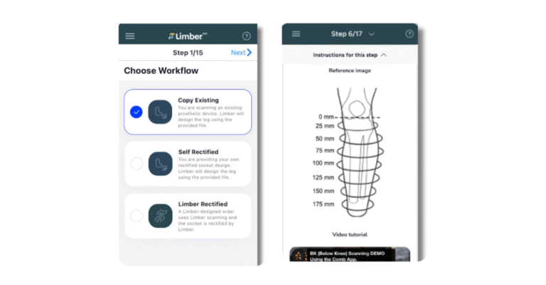 From Concept to Creation: Inside the Digital Workflow of Limber’s Prosthetic Manufacturing Process